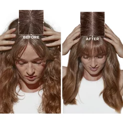 Kérastase Symbiose Micro-peeling Cellular Treatment For Sensitive Scalp Prone To Dandruff 200ml 6.8fl.oz 9 Kérastase Symbiose Micro-peeling Cellular Treatment For Sensitive Scalp Prone To Dandruff 200ml 6.8fl.oz -Ly-skin Sales Store Lyskin Kerastase symbiose micro peeling cellular treatment for sensitive scalp prone to dandruff 200ml KER00246 3