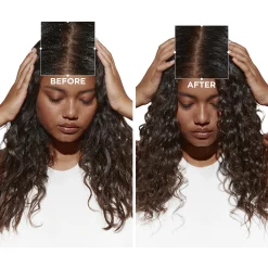 Kérastase Symbiose Moisturizing Anti-dandruff Shampoo Dry To Sensitive Scalp 250ml 8.5fl.oz 8 Kérastase Symbiose Moisturizing Anti-dandruff Shampoo Dry To Sensitive Scalp 250ml 8.5fl.oz -Ly-skin Sales Store Lyskin Kerastase symbiose moisturizing anti dundruff shampoo dry to sensitive scalp 250ml KER00248 2