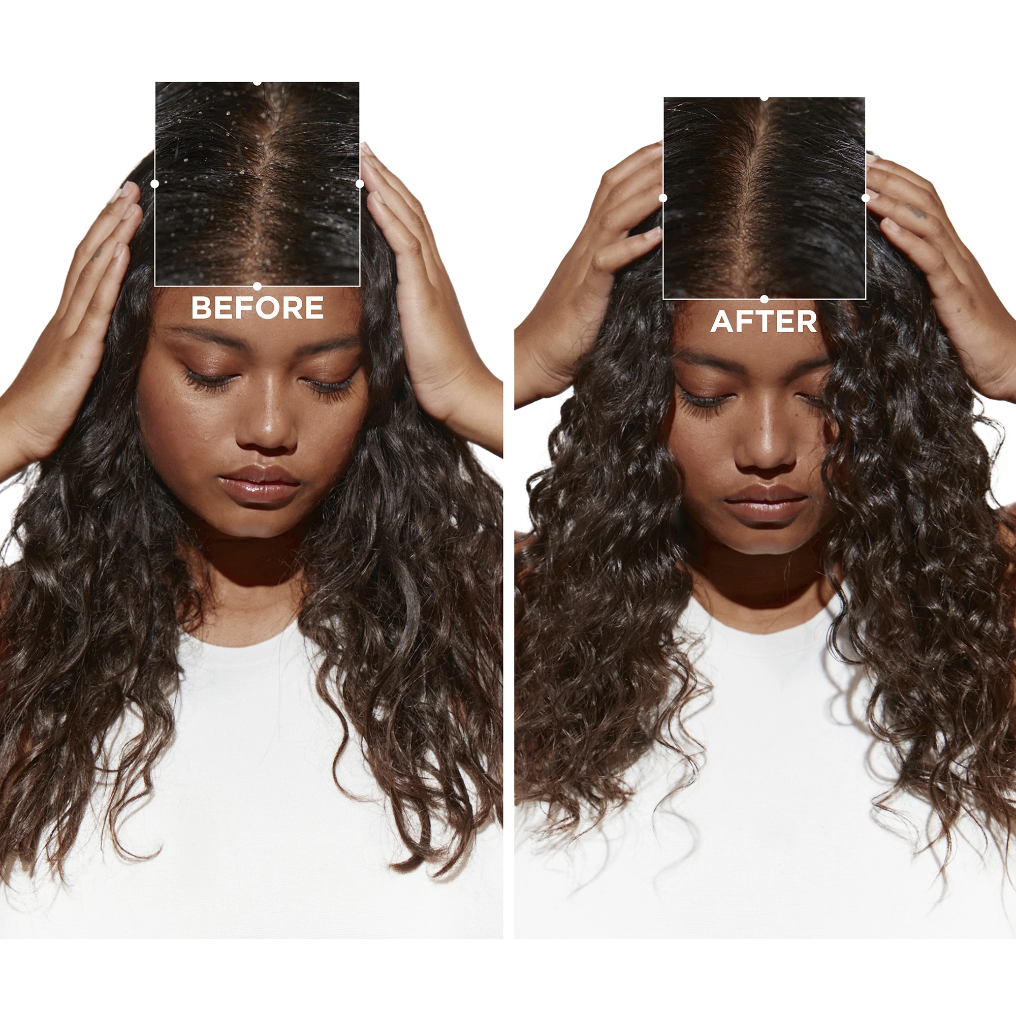 Kérastase Symbiose Moisturizing Anti-dandruff Shampoo Dry To Sensitive Scalp 250ml 8.5fl.oz 5 Kérastase Symbiose Moisturizing Anti-dandruff Shampoo Dry To Sensitive Scalp 250ml 8.5fl.oz - Image 3