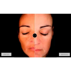 Mesoestetic Dermamelan Treatment pigment Control 30g 1.06oz 13 Mesoestetic Dermamelan Treatment pigment Control 30g 1.06oz -Ly-skin Sales Store lyskin mesoestetic dermamelan results III resultado