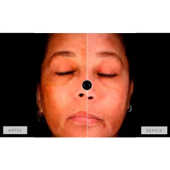 Mesoestetic Dermamelan Treatment pigment Control 30g 1.06oz 14 Mesoestetic Dermamelan Treatment pigment Control 30g 1.06oz -Ly-skin Sales Store lyskin mesoestetic dermamelan results II resultado