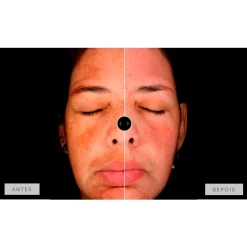 Mesoestetic Dermamelan Treatment pigment Control 30g 1.06oz 12 Mesoestetic Dermamelan Treatment pigment Control 30g 1.06oz -Ly-skin Sales Store lyskin mesoestetic dermamelan results IV resultado