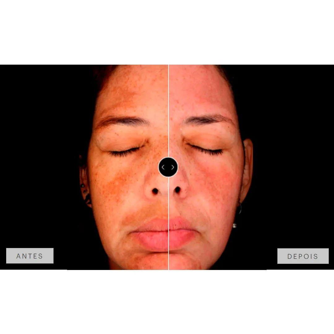 Mesoestetic Dermamelan Treatment pigment Control 30g 1.06oz 6 Mesoestetic Dermamelan Treatment pigment Control 30g 1.06oz - Image 4